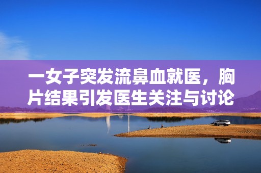 一女子突发流鼻血就医，胸片结果引发医生关注与讨论